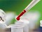 Эпидемиологи Приднестровья отмечают снижение регистрируемых случаев заболевания ВИЧ-инфекции