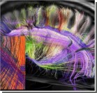 Трехмерная карта нейронных связей мозга озадачила ученых