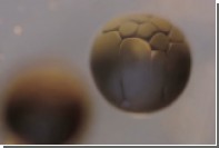 Развитие зародыша из единственной клетки сняли на видео