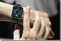 Apple   Apple Watch    