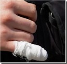 Война за джип: мужчина откусил гаишнику часть пальца