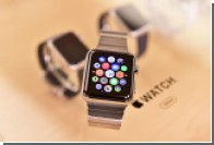  : Apple Watch     