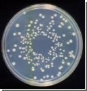 Микробы в кишечнике человека превращают его в "сверхорганизм"