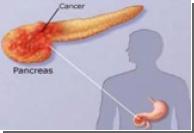 Установлена причина агрессивности рака поджелудочной железы