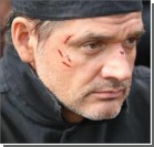  Актер Лавроненко госпитализирован после тяжелейшей аварии