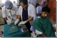 Хирурги удалили индийскому подростку 232 зуба