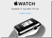 :   Apple Watch    31     25 000 