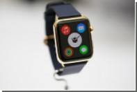   Apple Watch     2015 